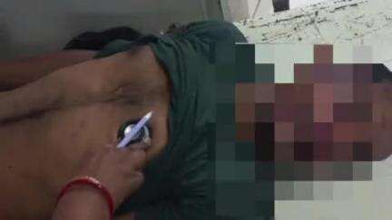 জয়নগর ১: বাইকের ধাক্কায় গুরুতর যখন ব্যক্তি চিকিৎসাধীন  পদ্মের হাটে
