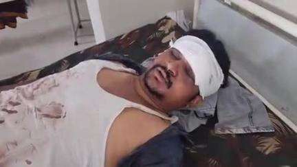खालवा: खंडवा: इंदौर रोड पर सड़क हादसे में युवक गंभीर रूप से घायल