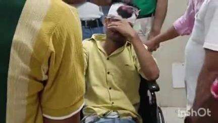 कायमगंज: गांव फैजबाग के पास 2 बाइकों की भिड़त में एक बाइक सवार 2 मौसेरे भाई घायल, जिला अस्पताल लोहिया में भर्ती