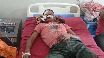 गोड्डा: पोड़ैयाहाट के घटबाड़ी मोड़ पर दूध गाड़ी और मछली लदी गाड़ी की टक्कर में 2 लोग घायल