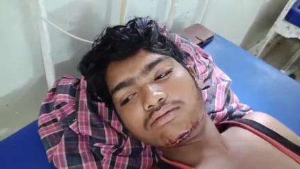 गोटेगांव: बरहटा के पास ट्रैक्टर की टक्कर से बाइक चालक घायल, जिला अस्पताल में भर्ती