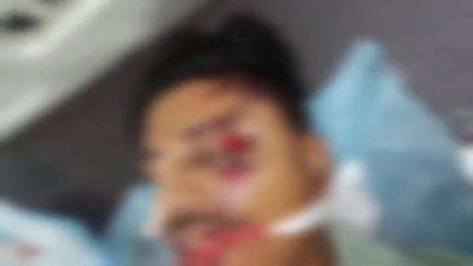 चकरनगर: सहसों थाना क्षेत्र में अज्ञात वाहन ने बाइक सवार युवक को मारी टक्कर, गंभीर हालत में पीजीआई सैफई रेफर