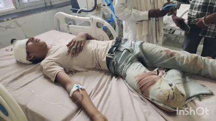 भीलवाड़ा: रोपा में सड़क पर अचानक आए पशु को बचाने के प्रयास में बाइक सवार दादा-पोता अनियंत्रित होकर गहरे गड्ढे में गिरे
