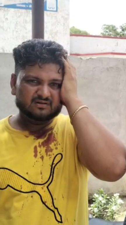 मेरठ: ग्राम घोसीपुर में पुरानी रंजिश के चलते दो भाइयों पर लाठी-डंडों से हमला, दोनों भाई घायल, पुलिस से की गई शिकायत