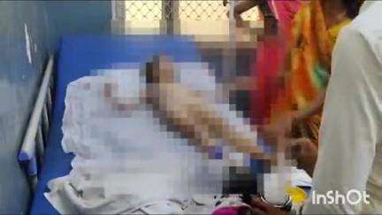 बांदा: अमारा गांव में छत से नीचे गर्म तेल की कढ़ाई में गिरी बालिका, गंभीर रूप से झुलसी