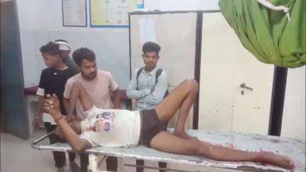 सतना: सोहावल मोड़ पर अज्ञात वाहन ने बाइक को मारी टक्कर, बाइक सवार गंभीर घायल