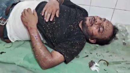 रसड़ा: रसड़ा में दलित युवती की शादी के लिए दुल्हे के रथ पर आने से नाराज मनबढ़ों ने किया जानलेवा हमला, दो लोग हुए जख्मी