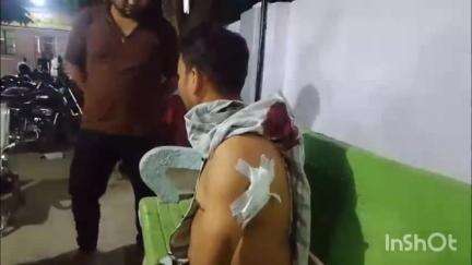 उन्नाव: अकरमपुर में पति-पत्नी के झगड़े में समझाने गए व्यक्ति पर युवक ने चाकू से किया हमला, व्यक्ति घायल