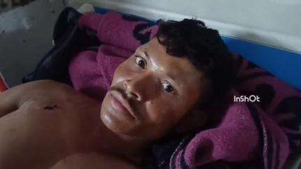 जिला अस्पताल में भर्ती टाइगर के हमले से घायल फॉरेस्ट चौकीदार की हालत में हुआ सुधार, दी घटना की जानकारी