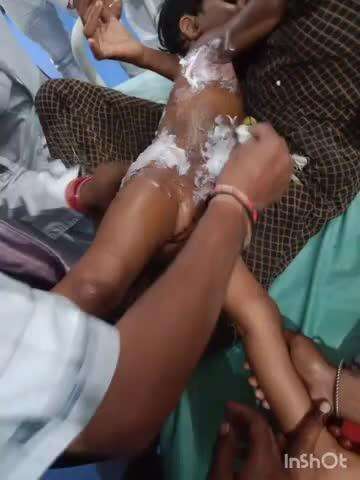 बस्तर: बेलगुडा में ढाई साल की बच्ची गर्म चावल के पानी में गिरने से गंभीर रूप से घायल, डायल 112 ने अस्पताल में करवाया भर्ती