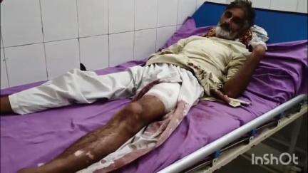 देवबंद: आपसी विवाद में भतीजे ने फूफा को मारी गोली, हालत गंभीर, देवबंद थाना क्षेत्र के गांव लखनौती की घटना