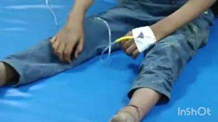 कायमगंज: गांव सिकन्दरपुर निवासी 6 वर्षीय बालक को घर के बाहर खेलते समय सांप ने काटा, हालत बिगड़ी, जिला अस्पताल लोहिया में भर्ती