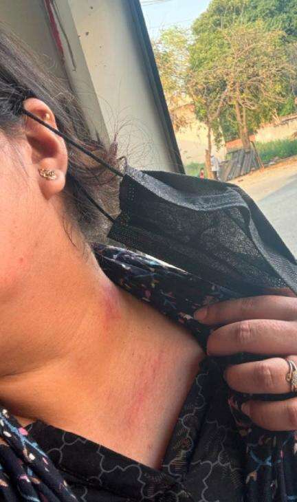 यूपी के अंबेडकर नगर में जेठ और देवर ने महिला से की मारपीट, अर्धनग्न कर गाल पर गड़ा दिए दांत