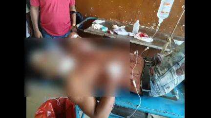 চাকদা: মদনপুর কাজী বাগানে এক যুবককে গলায় খুর মেরে খুনের চেষ্টা দুষ্কৃতীদের,চলন্ত অটোয় উঠে কোনো ক্রমে পালিয়ে বাঁচলেন ওই যুবক