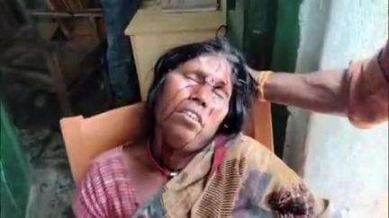 पातेपुर: हरलोचनपुर थाना क्षेत्र के चकफैज गांव में बच्चों के विवाद में दो पक्षों में मारपीट हुई, एक महिला गंभीर रूप से घायल