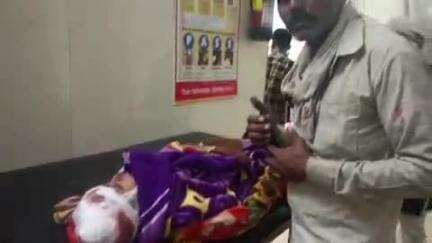 टीकमगढ़: माडूमर गांव में तेज आंधी-तूफान से लोहे की चद्दर गिरने से 5 साल की बच्ची गंभीर रूप से घायल
