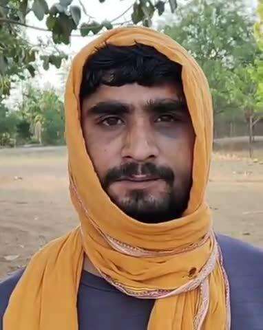 लिधौरा: बम्होरी खास में युवक से मारपीट, पुलिस पर कार्रवाई न करने का आरोप, SP से शिकायत
