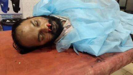 মোহনপুর: রানিরবাজারে স্কুটি ও বাইকের মুখোমুখি সংঘর্ষে নিহত ১