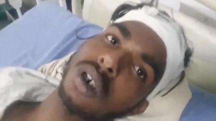 शाहाबाद: पुरैना गाँव में सड़क पर अंडा खाने के विवाद में मारपीट, एक पक्ष के चार लोगों ने दूसरे पक्ष के युवक को पीटा