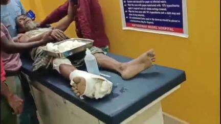 শিলচর: কাটিগড়ায় কাটিগড়া-হরিনগর পূর্ত সড়কে বাইকের ধাক্কায় জখম পথচারী