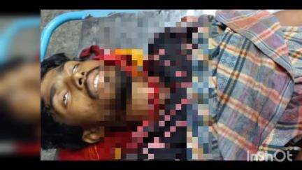 হরিরামপুর: হরিরামপুর থানার দৌলতপুর এলাকায় এক যুবকে গলায় ধারালো অস্ত্রের কোপ, ঘটনার পরে মৃত্যু হয় যুবকের