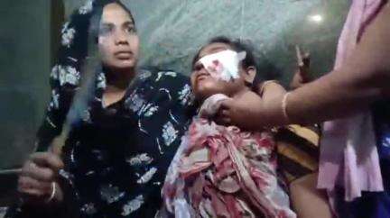 ডোমকল: বারোমাসিয়া এলাকায় মাস্তানি করে জমি দখল করতে গিয়ে ভাই বোনকে পেটালো স্থানীয় দুষ্কৃতীরা, ডোমকল থেকে রেফার বহরমপুর
