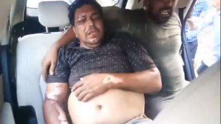 आदित्यपुर गम्हरिया: चाड़री के पास हाईटेंशन तार की चपेट में आने से एक व्यक्ति झुलसा, गंभीर हालत में अस्पताल में भर्ती