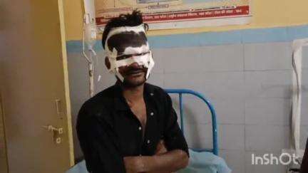 अलीगंज: शराबी युवक की नशे में बाइक अनियंत्रित होने से घायल, एंबुलेंस में घायल अवस्था में मचाया तांडव, बमुश्किल भर्ती