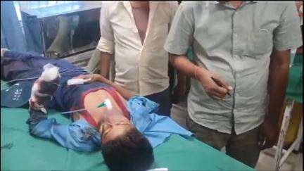 अररिया: दल्लू टोला में देशी बम फटने से एक छात्र का बायां हाथ उड़ा, सदर अस्पताल में इलाज के बाद हायर सेंटर रेफर