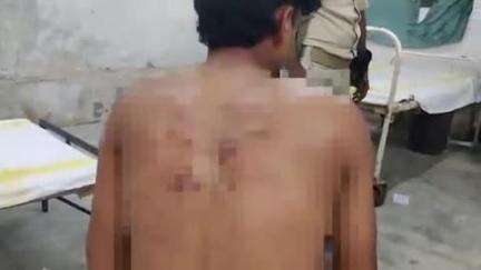 असरगंज: कुमैठा गांव में यज्ञ देखने आए तारापुर के युवक पर मनचलों ने की पिटाई, पुलिस ने कराया इलाज