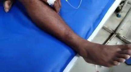 हाथरस: गांव वैरीसला में खेत में पानी लगाते समय युवक को सांप ने काटा, झाड़-फूंक के बाद हालत बिगड़ने पर परिजन लाए अस्पताल