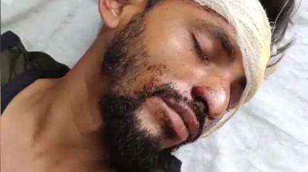 नरसिंहपुर: भोपाल जाते समय बरेली के समीप सड़क हादसे में बाइक सवार युवक हुआ घायल, जिला अस्पताल में उपचार जारी