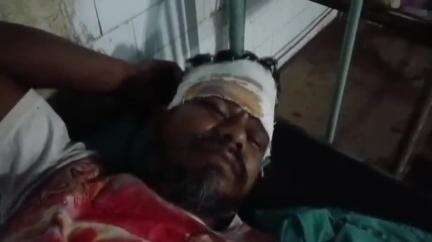 তুফানগঞ্জ ১: দরিয়া বালাই বটতলা এলাকায় রাজ্য সড়কের ওপর মোটরসাইকেলের ধাক্কায় আহত সাইকেল আরোহী