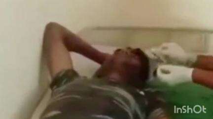 पठारी: कुरवाई मार्ग पर तेज रफ्तार मोटरसाइकिल फिसलने से चालक घायल, अस्पताल में इलाज जारी