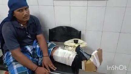 बांका: बाघाकोल गांव में पेड़ से गिरकर युवक जख्मी, एक पैर टूटा