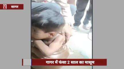 सागर जिले में गागर में फंसा 2 साल का मासूम, बर्तन काटकर सुरक्षित निकाला गया