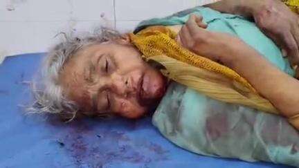 అనంతపురం నగరంలోని లక్ష్మీ నగర్ వద్ద గూడ్స్ ఢీకొన్న సంఘటనలు గాయపడిన వృద్ధురాలు చికిత్స పొందుతూ మృతి