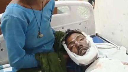 सिमरी बख्तियारपुर: कोपरिया स्टेशन: ट्रेन की बोगी पर चढ़ा व्यक्ति हाईटेंशन तार की चपेट में आने से बुरी तरह जख्मी