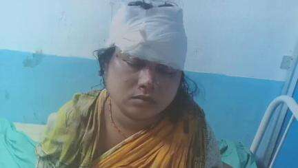 গাজোল: মাতইল 81 নং জাতীয় সড়ক এলাকায় বাইকের চাকায় ঢুকল বিড়াল, আহত মহিলা