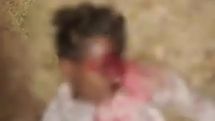 ಕೊಟ್ಟೂರು: ಮಂಗನಹಳ್ಳಿ ಕ್ರಾಸ್ ಬಳಿ ಬೈಕ್‌ಗೆ ಆಟೋ ಡಿಕ್ಕಿ, ಸವಾರ ಸ್ಥಳದಲ್ಲೇ ಸಾವು