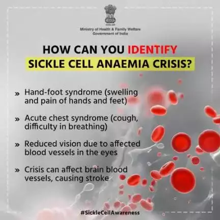 #SickleCellAwareness | Be Aware, Be Prepared!