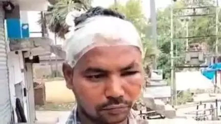 अतरी: टेउसा बाजार में थम्सअप नहीं देने पर व्यक्ति के साथ मारपीट, मामला दर्ज