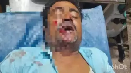 হাড়োয়া: কাকুড়িয়া এলাকায় মোটরবাইক দূর্ঘটনায় গুরুতর আহত হলেন এক ব্যক্তি