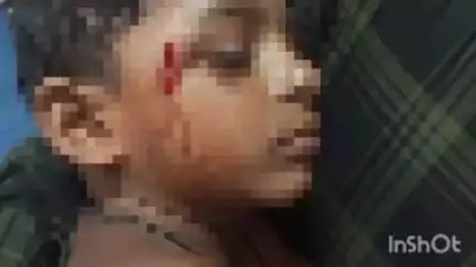 হাড়োয়া: রামনগর এলাকায় মোটরবাইকের ধাক্কায় আহত পথচারী শিশু
