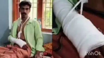 വടകര: കക്കംവെള്ളിയിൽ സ്ലാബില്ലാത്ത ഓടയിൽ വീണ് യുവ ടാക്‌സി ഡ്രൈവറുടെ കൈക്കും കാലിനും പൊട്ടലേറ്റു