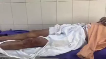 हांसी: हांसी में दो बाइक की टक्कर, पांच लोग घायल, तीन की हालत गंभीर, बीमार साले का हालचाल पूछने जा रहे थे