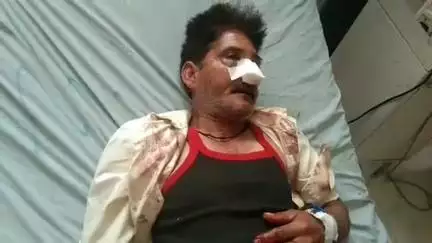 सहाड़ा: गुरला के समीप दो बाइकों की आपस में हुई जोरदार भिड़ंत, हादसे में एक बाइक सवार हुआ घायल