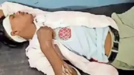 केसली: पटना मेहका रोड पर अनियंत्रित बाइक से गिरकर पिता-पुत्र हुए घायल, अस्पताल में भर्ती
