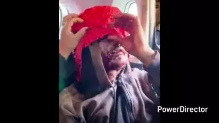 नौहरा: घंडूरी गांव में 40 वर्षीय व्यक्ति पर भालू ने किया हमला, घायल अवस्था में आईजीएमसी किया गया रेफर