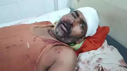 रैपुरा: गुंदलहा नाले के पास बेलगाम ट्रक ने बाइक सवार को मारी टक्कर, घायल आधे घंटे तक सड़क पर तड़पता रहा